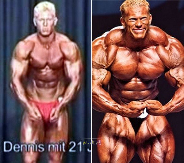 dennis wolf before and after